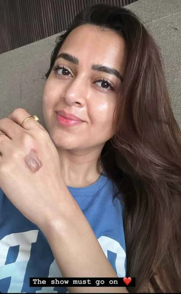 tejasswi prakash injured